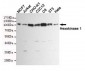 Anti-Hexokinase 1 Antibody (6B8-G11-E7)